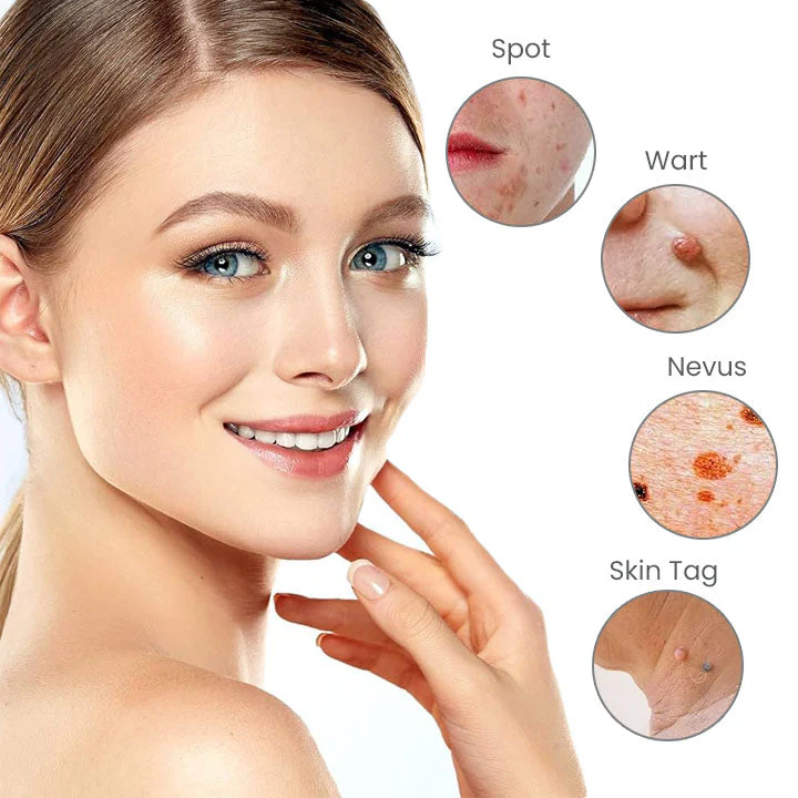 Fivfivgo™ Portable Laser Spot Cleaning Pen 3 Fivfivgo™ Portable Laser Spot Cleaning Pen