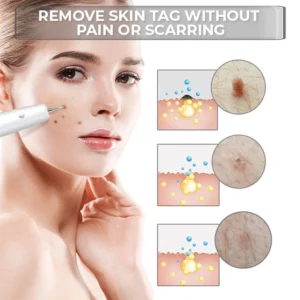 Fivfivgo™ Portable Laser Spot Cleaning Pen 6 Fivfivgo™ Portable Laser Spot Cleaning Pen