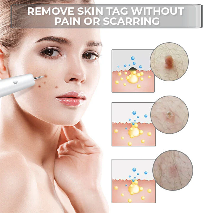 Fivfivgo™ Portable Laser Spot Cleaning Pen 2 Fivfivgo™ Portable Laser Spot Cleaning Pen