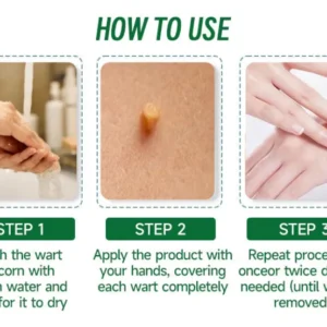 Fivfivgo™ 20% Salicylic Acid Skin Treatment Cream 19 Fivfivgo™ 20% Salicylic Acid Skin Treatment Cream