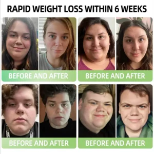 Croaie® GLP-1 Moringa Slimming & Health Boost Drops