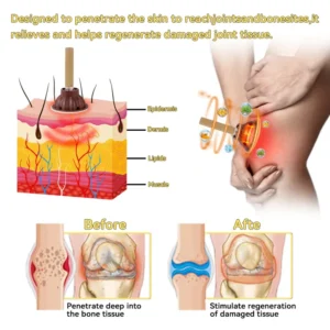 Fivfivgo™ Bioactive Wormwood Heat Therapy Stick 21 Fivfivgo™ Bioactive Wormwood Heat Therapy Stick