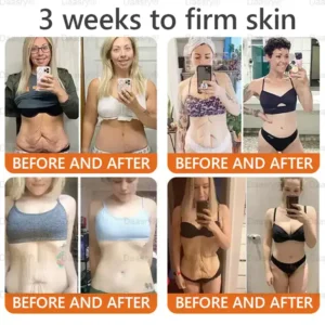 Daasry® “Dermal Gold” Botox Bee Venom Skin Restoration Cream 25 Daasry® “Dermal Gold” Botox Bee Venom Skin Restoration Cream