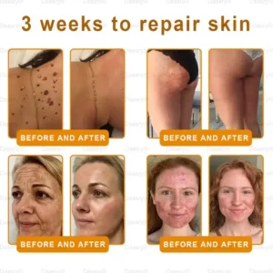 Daasry® “Dermal Gold” Botox Bee Venom Skin Restoration Cream 18 Daasry® “Dermal Gold” Botox Bee Venom Skin Restoration Cream