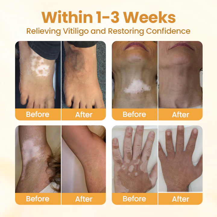 BBOJI™ VitiClear Pro Bee Toxin Cream 3 BBOJI™ VitiClear Pro Bee Toxin Cream