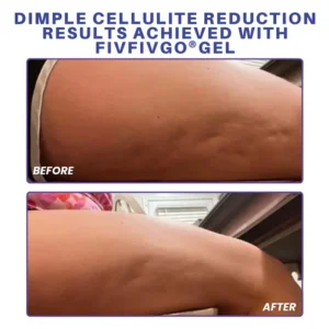 Fivfivgo® PDRN-GLP-1 Cellulite Targeting Reedle Shot Gel 18 Fivfivgo® PDRN-GLP-1 Cellulite Targeting Reedle Shot Gel