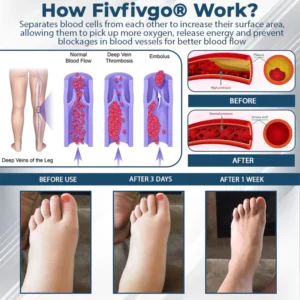 Fivfivgo® VenoHerb Black Cumin Edema Relief Balm 19 Fivfivgo® VenoHerb Black Cumin Edema Relief Balm