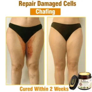 LOVILDS® Full-Body Repair Cream 21 LOVILDS® Full-Body Repair Cream