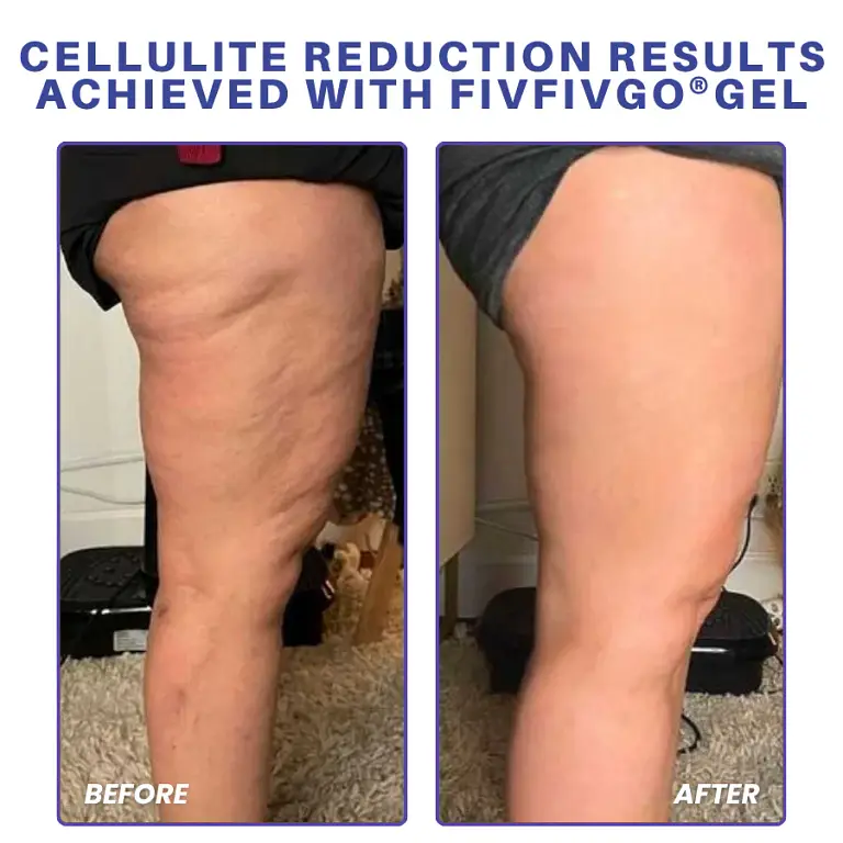 Fivfivgo® PDRN-GLP-1 Cellulite Targeting Reedle Shot Gel 8 Fivfivgo® PDRN-GLP-1 Cellulite Targeting Reedle Shot Gel
