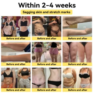 Fivfivgo™ Bioactive Wormwood Heat Therapy Stick 19 Fivfivgo™ Bioactive Wormwood Heat Therapy Stick