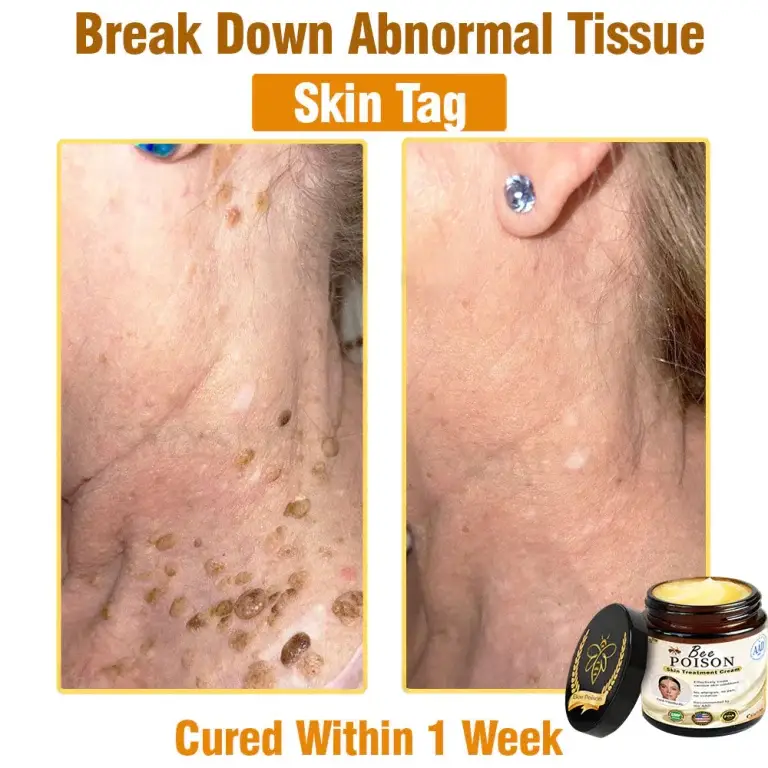 LOVILDS® Full-Body Repair Cream 10 LOVILDS® Full-Body Repair Cream