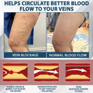 Fivfivgo® VenoHerb Black Cumin Edema Relief Balm 17 Fivfivgo® VenoHerb Black Cumin Edema Relief Balm