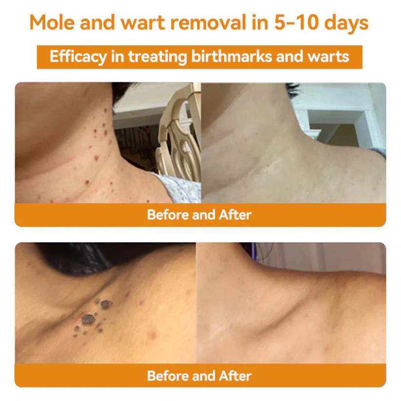 Cvreoz® Bee Venom Skin Treatment Cream 3 Cvreoz® Bee Venom Skin Treatment Cream