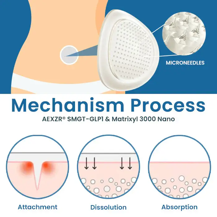 AEXZR® SMGT-GLP1 & Matrixyl 3000 Nano Microneedle Patch 4 AEXZR® SMGT-GLP1 & Matrixyl 3000 Nano Microneedle Patch