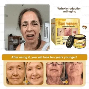 APKAPK™ Bee Venom Skin Treatment Cream 33 APKAPK™ Bee Venom Skin Treatment Cream