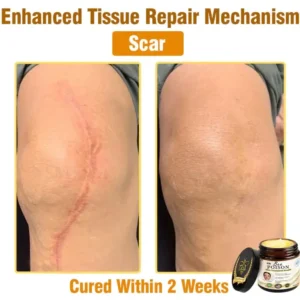 LOVILDS® Full-Body Repair Cream 19 LOVILDS® Full-Body Repair Cream