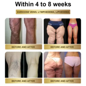 TOOYES® GLP-1 Slimming & Health Boost Drops Food-grade fat burner 12 TOOYES® GLP-1 Slimming & Health Boost Drops Food-grade fat burner