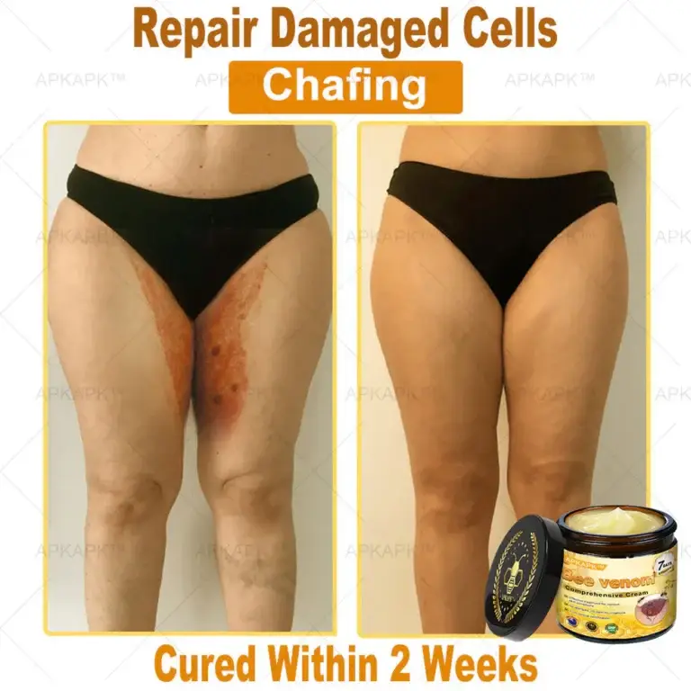 APKAPK™ Bee Venom Skin Treatment Cream 8 APKAPK™ Bee Venom Skin Treatment Cream