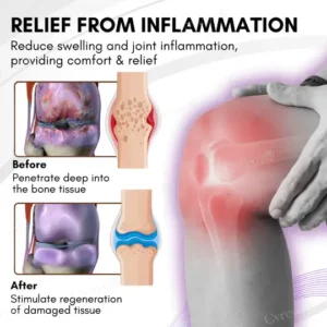 Cvreoz® Turmeric & Emu Oil Arthritis Soothing Pain Relief Massage Gel 11 Cvreoz® Turmeric & Emu Oil Arthritis Soothing Pain Relief Massage Gel