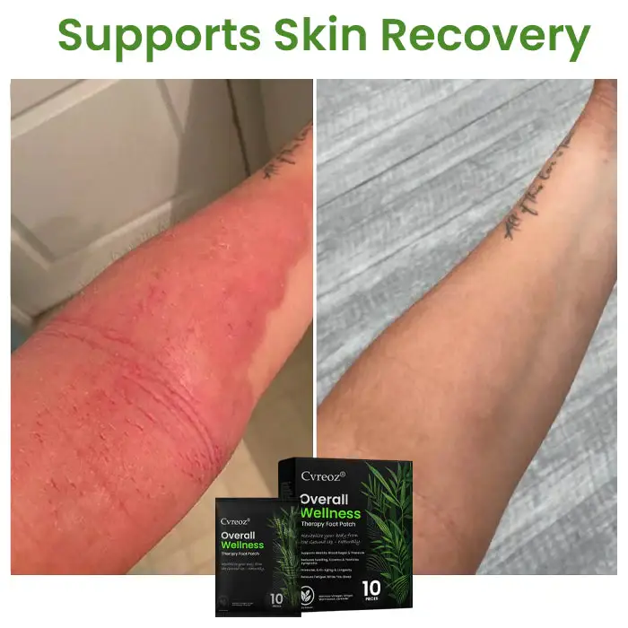 Cvreoz® Overall Wellness Therapy Foot Patch 4 Cvreoz® Overall Wellness Therapy Foot Patch