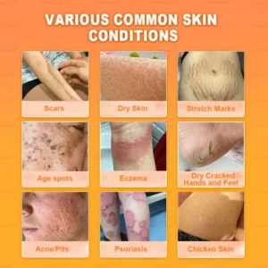 Fivfivgo™ Therapeutic Horse Oil Cream 16 Fivfivgo™ Therapeutic Horse Oil Cream