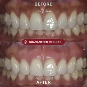 HealRay Red Light Therapy System 12 HealRay Red Light Therapy System