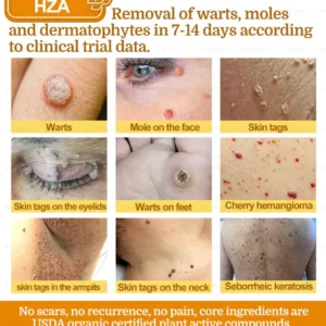 HZA7-Day Rapid Skin Repair Cream UK Dermatologist Approved 22 HZA7-Day Rapid Skin Repair Cream UK Dermatologist Approved