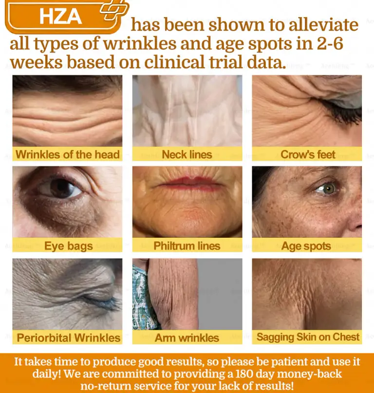 HZA7-Day Rapid Skin Repair Cream UK Dermatologist Approved 9 HZA7-Day Rapid Skin Repair Cream UK Dermatologist Approved
