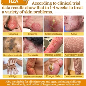 HZA7-Day Rapid Skin Repair Cream UK Dermatologist Approved 20 HZA7-Day Rapid Skin Repair Cream UK Dermatologist Approved