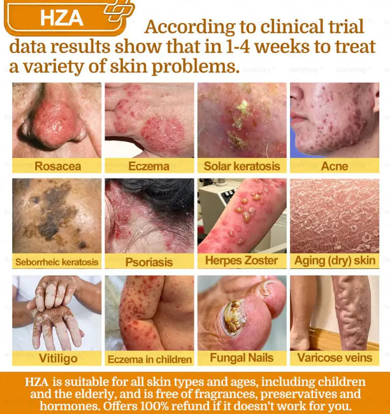 HZA7-Day Rapid Skin Repair Cream UK Dermatologist Approved 8 HZA7-Day Rapid Skin Repair Cream UK Dermatologist Approved