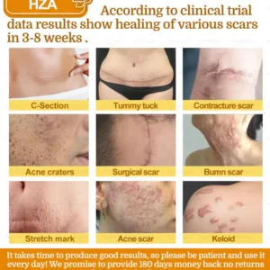 HZA7-Day Rapid Skin Repair Cream UK Dermatologist Approved 19 HZA7-Day Rapid Skin Repair Cream UK Dermatologist Approved