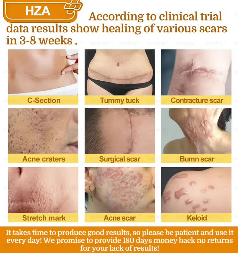 HZA7-Day Rapid Skin Repair Cream UK Dermatologist Approved 7 HZA7-Day Rapid Skin Repair Cream UK Dermatologist Approved