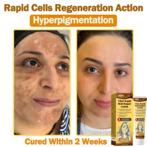 HZA7-Day Rapid Skin Repair Cream UK Dermatologist Approved 17 HZA7-Day Rapid Skin Repair Cream UK Dermatologist Approved