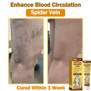 HZA7-Day Rapid Skin Repair Cream UK Dermatologist Approved 16 HZA7-Day Rapid Skin Repair Cream UK Dermatologist Approved