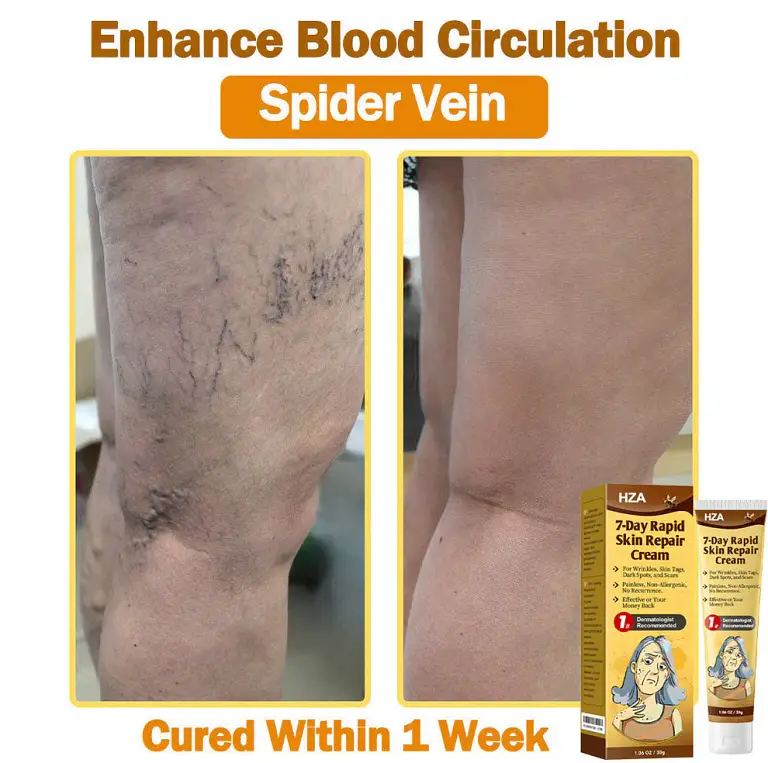 HZA7-Day Rapid Skin Repair Cream UK Dermatologist Approved 4 HZA7-Day Rapid Skin Repair Cream UK Dermatologist Approved