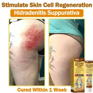 HZA7-Day Rapid Skin Repair Cream UK Dermatologist Approved 25 HZA7-Day Rapid Skin Repair Cream UK Dermatologist Approved