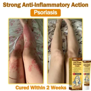 HZA7-Day Rapid Skin Repair Cream UK Dermatologist Approved 15 HZA7-Day Rapid Skin Repair Cream UK Dermatologist Approved