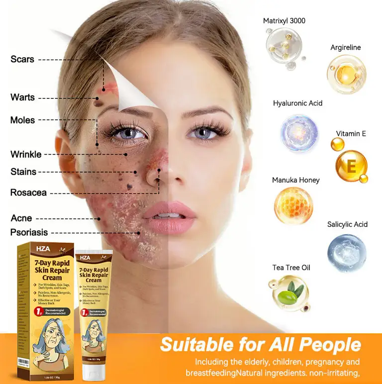 HZA7-Day Rapid Skin Repair Cream UK Dermatologist Approved 1 HZA7-Day Rapid Skin Repair Cream UK Dermatologist Approved