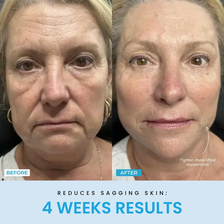 Liftlab Sculptor + Free Serum 12 Liftlab Sculptor + Free Serum