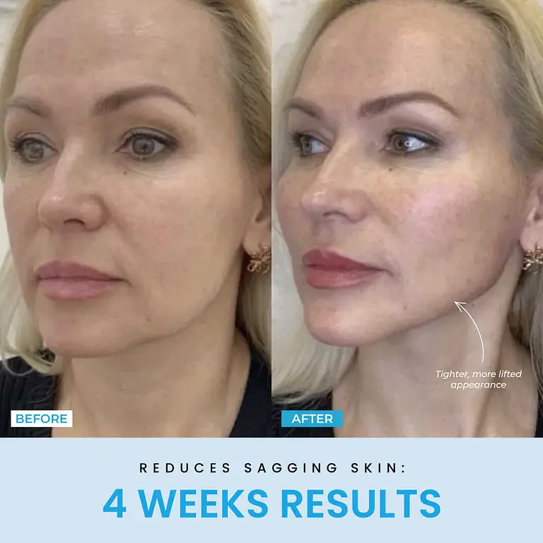 Liftlab Sculptor + Free Serum 10 Liftlab Sculptor + Free Serum