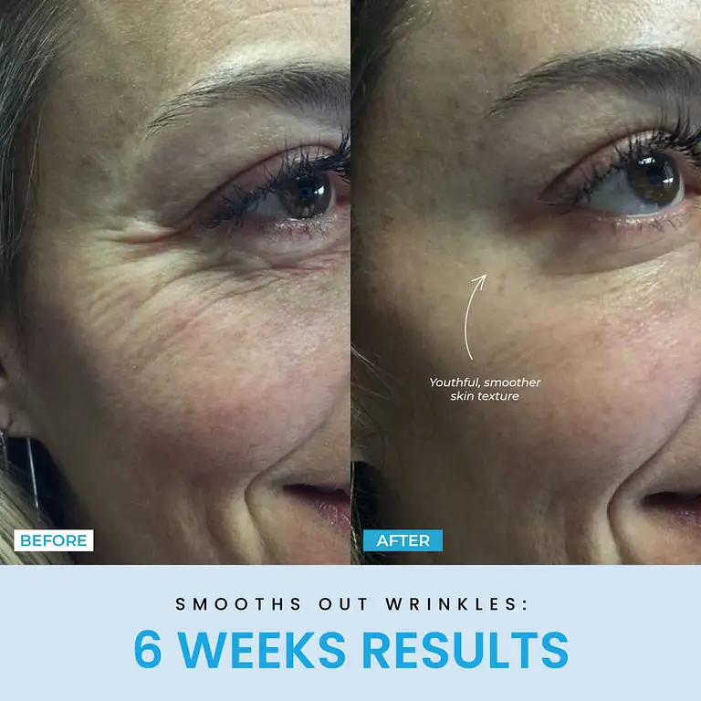 Liftlab Sculptor + Free Serum 9 Liftlab Sculptor + Free Serum