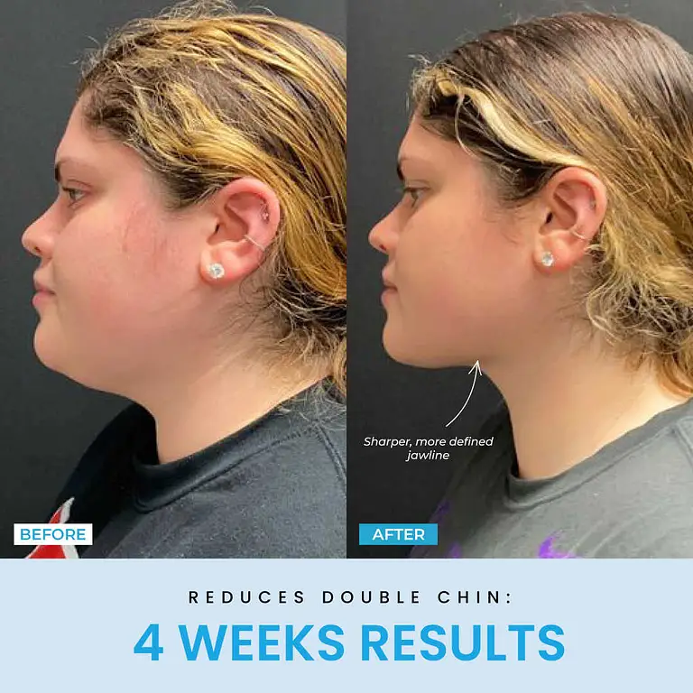 Liftlab Sculptor + Free Serum 5 Liftlab Sculptor + Free Serum