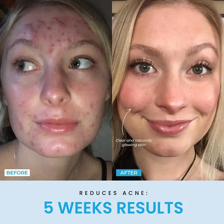 Liftlab Sculptor + Free Serum 3 Liftlab Sculptor + Free Serum