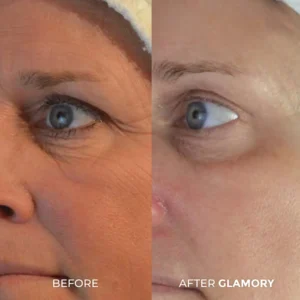 Glamory The MicroLift