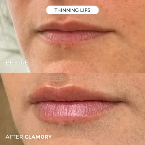 Glamory The MicroLift