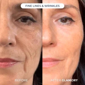 Glamory The MicroLift