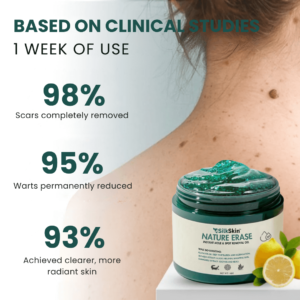 SilkSkin™ | Clinically Proven to Remove 97% of Moles, Warts & Blemishes – Permanently in Just 3 Days!