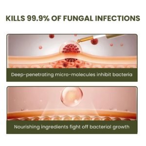 NailCure™ Fungal Nail Drops | Removes 90% of Nail Fungus in 7 Days