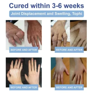 Ourlyard™ Magnesium Pain Healing Bone Cream 16 Ourlyard™ Magnesium Pain Healing Bone Cream