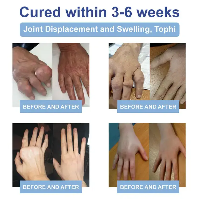 Ourlyard™ Magnesium Pain Healing Bone Cream 3 Ourlyard™ Magnesium Pain Healing Bone Cream